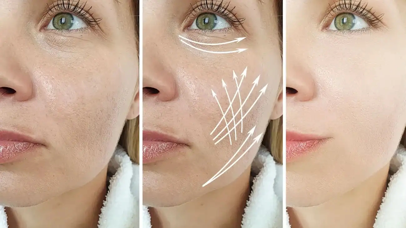 Can One Treatment Really Tackle More Than One Skin Concern Bushey?