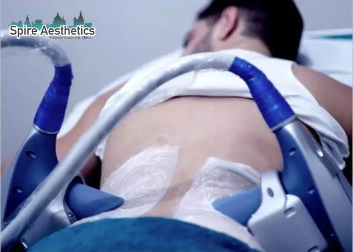 Man having fat freezing treatment done on love handles before a competitions Bushey to create a sculpted look.