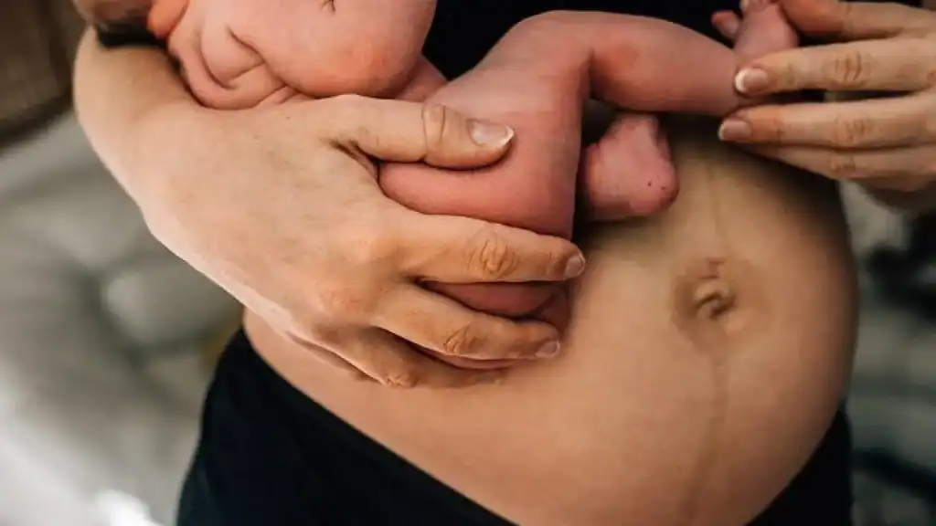 Why Is My Stomach Still Big After Pregnancy Bushey?